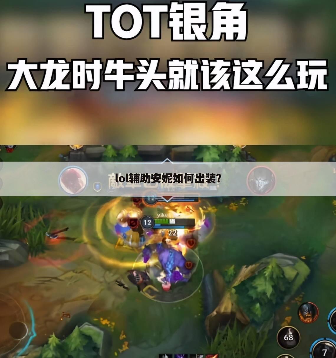 lol辅助安妮如何出装?