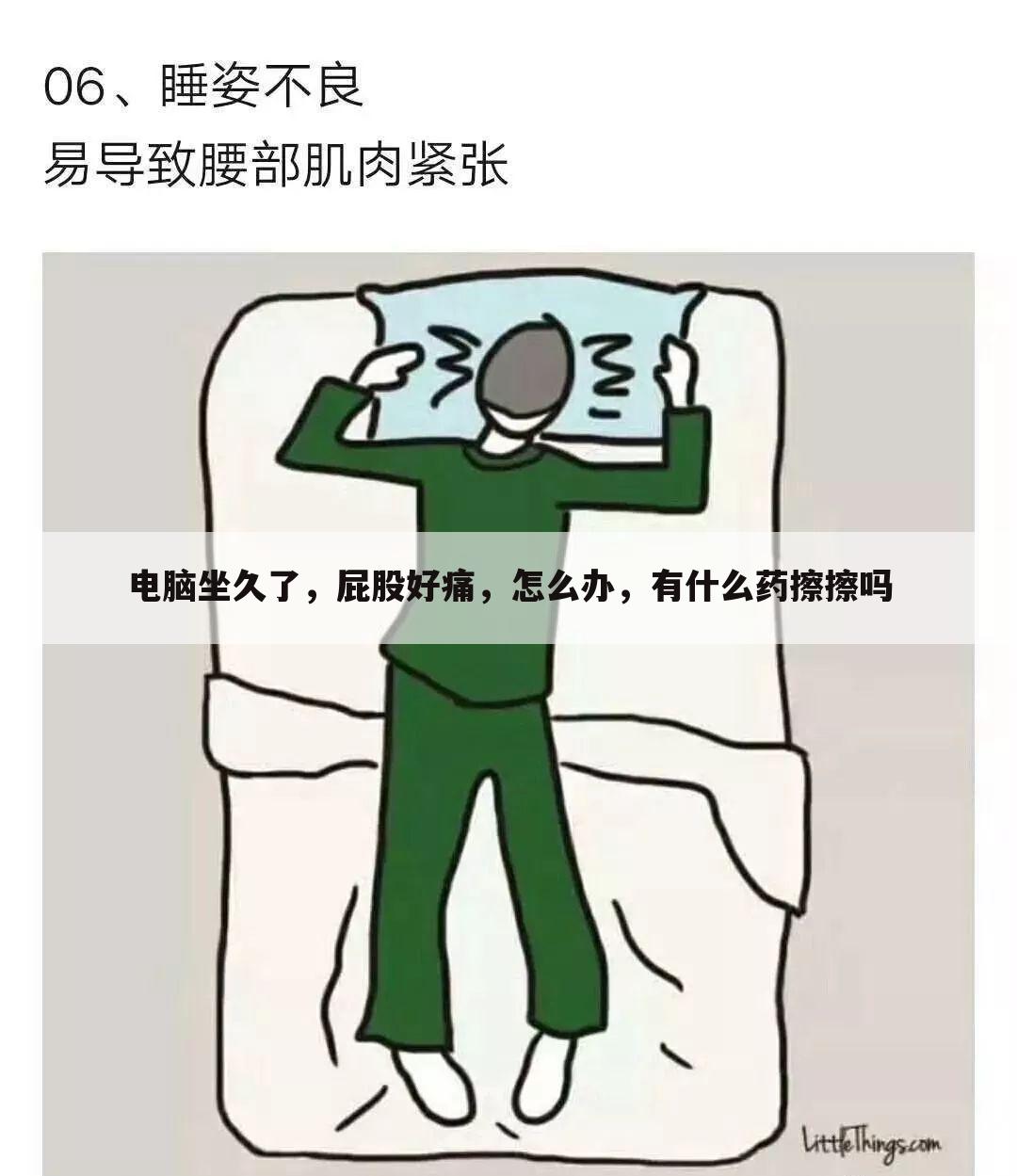电脑坐久了,屁股好痛,怎么办,有什么药擦擦吗