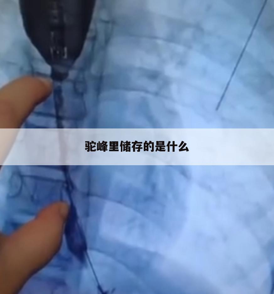 驼峰里储存的是什么